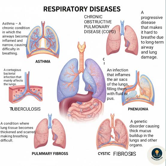 Respiratory diseases images with types and symptoms