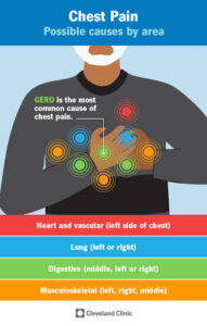Chest pain causes diagram showing different pain area. 