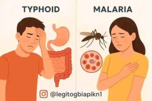 Persistent fever misdiagnosed as malaria  
Typhoid confirmed