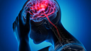 Headache causes and when to worry